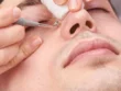 Mens Facials for Black head removal in Havelock town, Colombo 5.