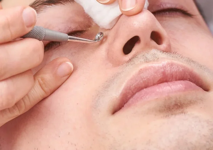 Mens Facials for Black head removal in Havelock town, Colombo 5.